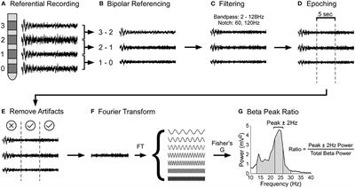 Subthalamic Peak Beta Ratio Is Asymmetric in Glucocerebrosidase Mutation Carriers With Parkinson's Disease: A Pilot Study